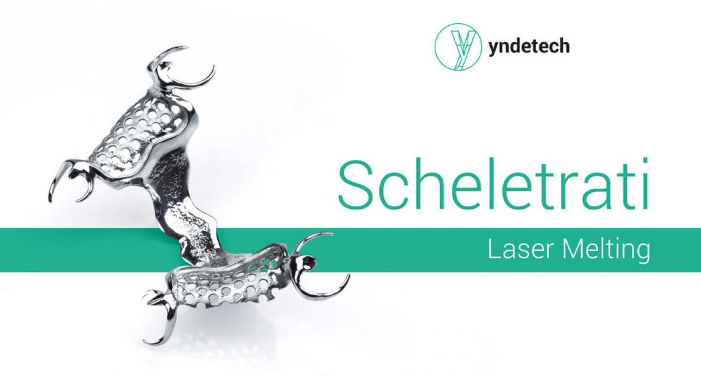 scheletrato-in-laser-melting-yndetech-1024x550