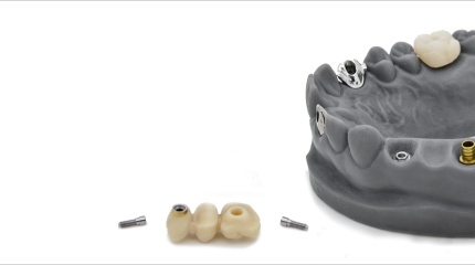 modello-dentale-componentistica-implantare-produzione-yndetech