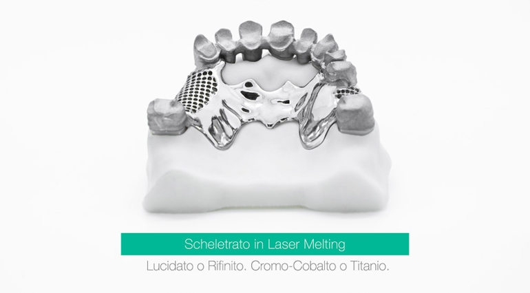 scheletrato-in-laser-melting-cromo-cobalto-titanio