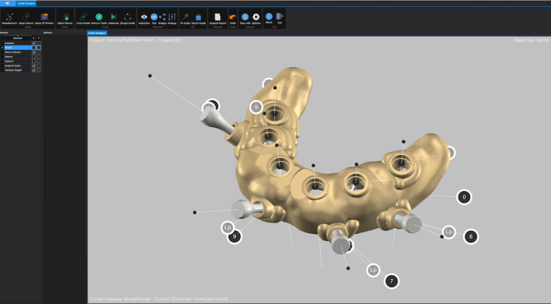 implant-3d4-min